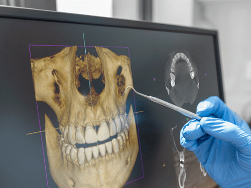 CBCT Cone Beam Technology